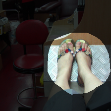layer4-1418